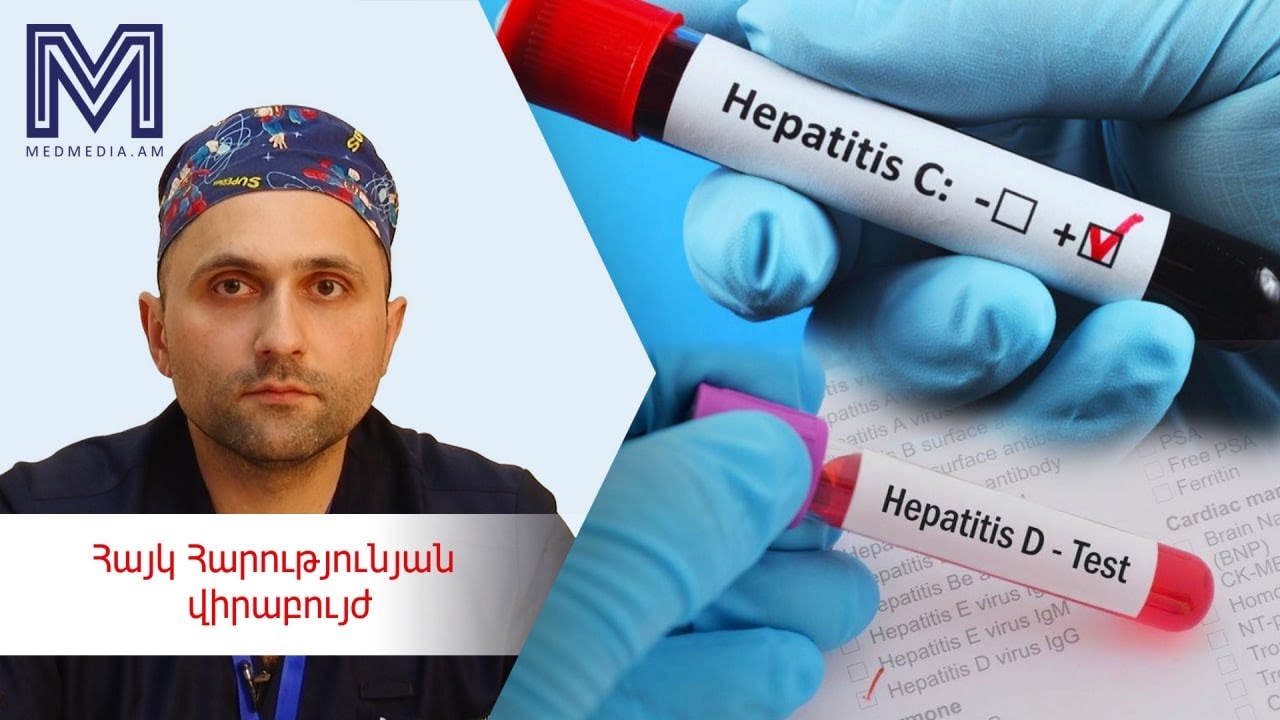 Երեք խորհուրդ բժշկից․ հեպատիտ