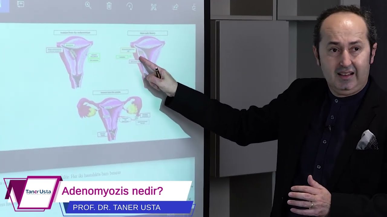 Adenomyozis Nedir? | Prof. Dr. Taner Usta