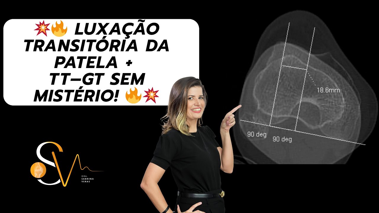 🔥 LUXAÇÃO TRANSITÓRIA DA PATELA + TT– GT SEM MISTÉRIO! 🔥