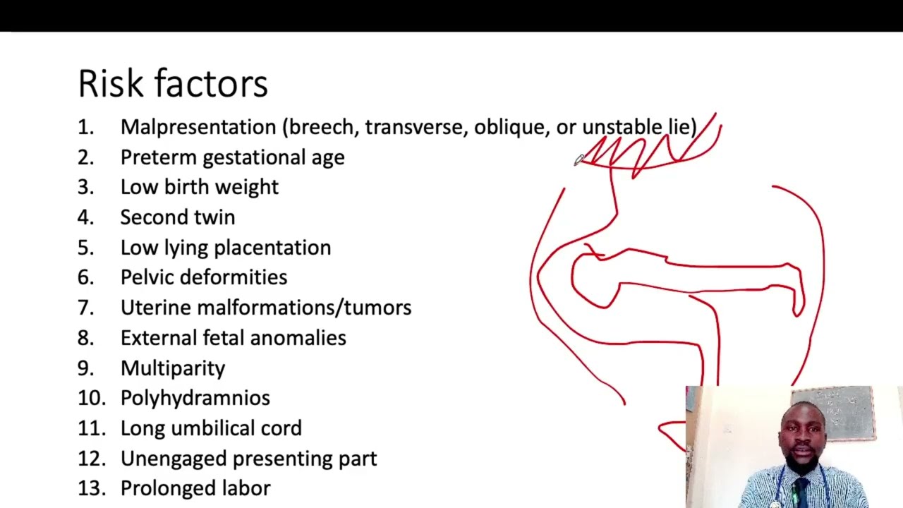 Cord Prolapse
