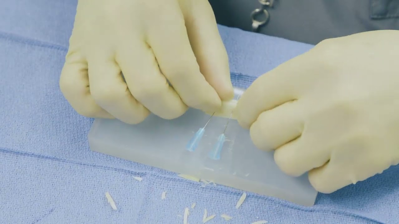 Septal Extention Graft Sequence 1 OPT a