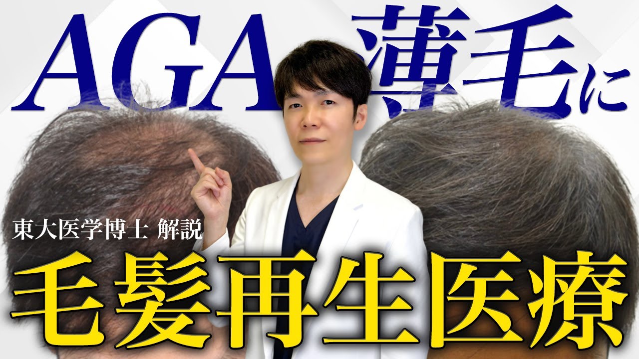 AGAに新たな選択肢！幹細胞培養上清液の効果を医師が解説【再生医療】