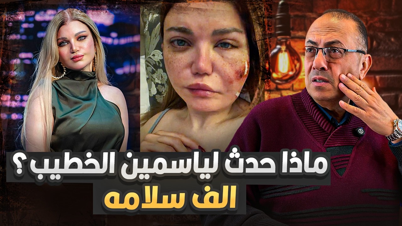 سبحان الله ياسمين الخطيب اتشوهت وجمالها  ضاع والسبب |  حنفي السيد يعرض القصه كامله !!