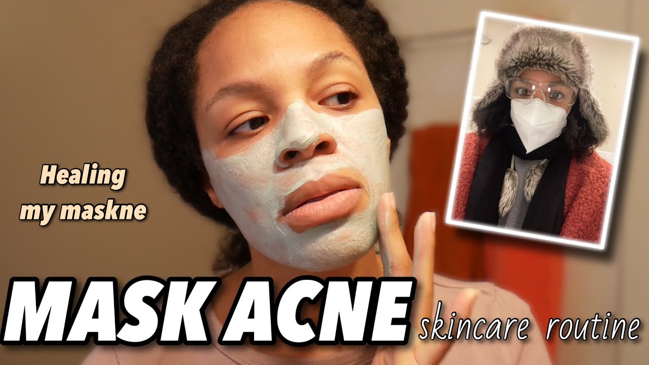 Treat Mask Acne // Cruelty Free MASKNE Skincare Routine