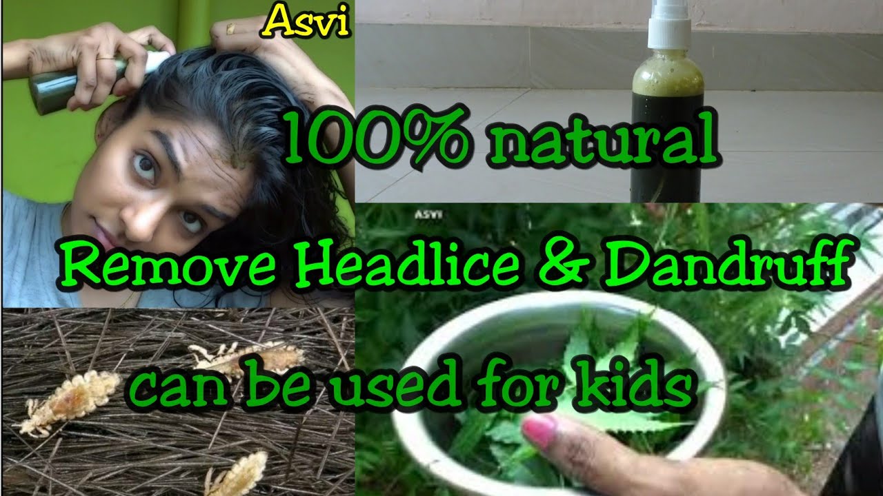 How to remove head lice & dandruff|💯%natural home remedy|can be used for kids|100% effective|Asvi