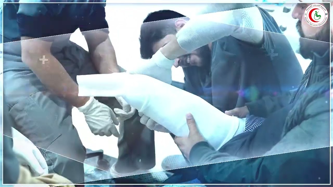 أخذ القالب هو إحدى المراحل الأساسية التي تسبق تركيب الطرف الصناعي للجـ،،ـرحى