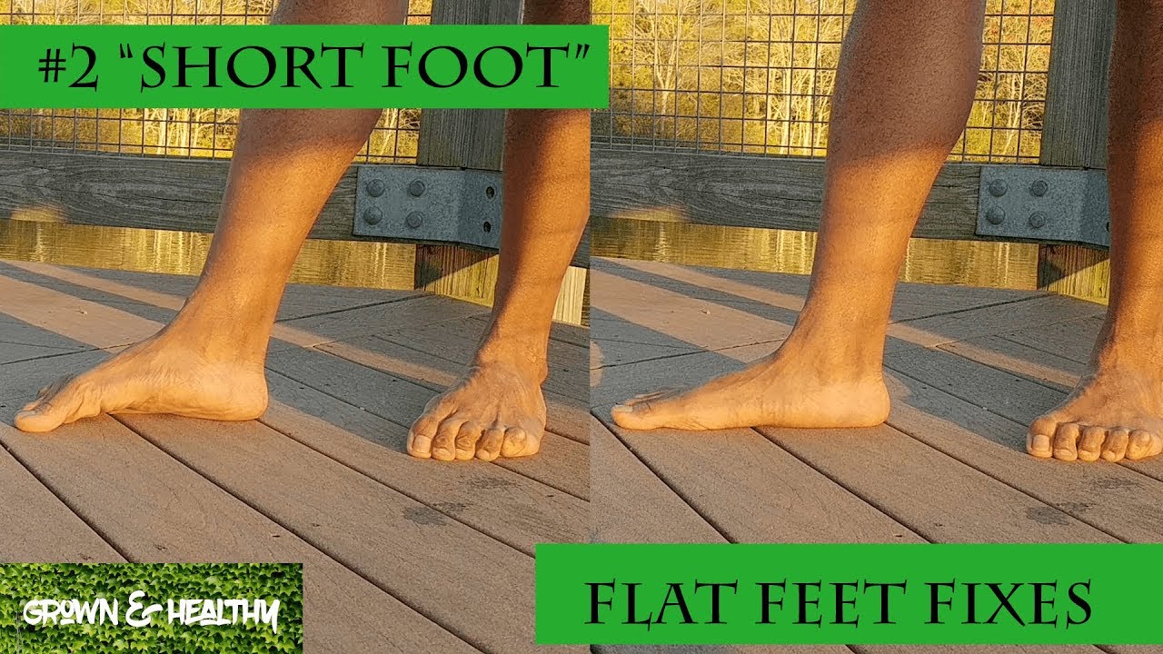 Fix Flat Feet #2