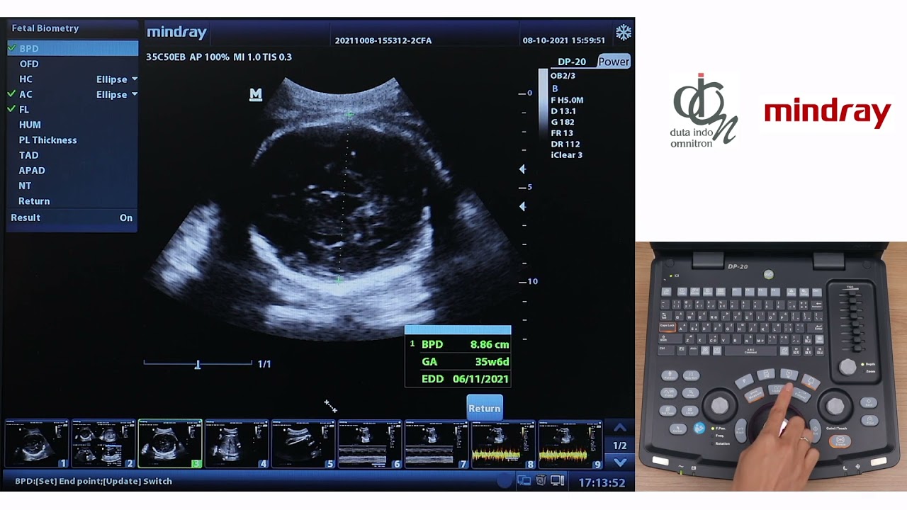 B Mode DP20/DP10