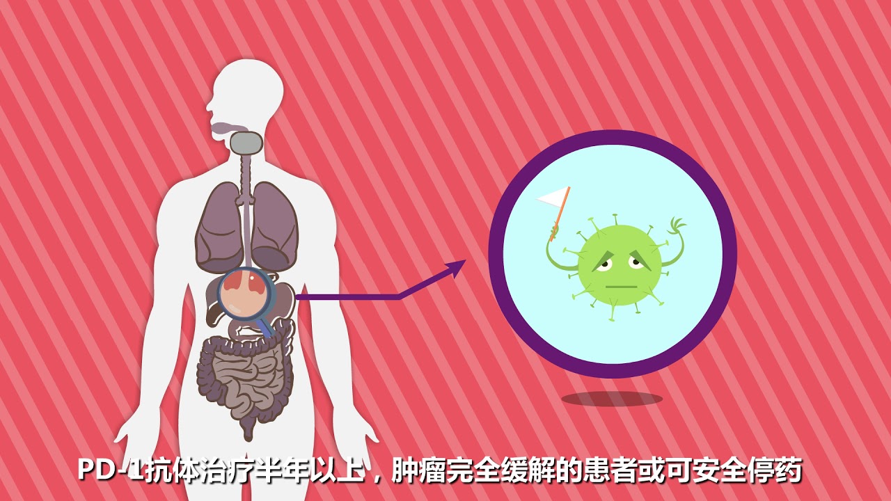 PD-1一旦有效，多久可以停藥？