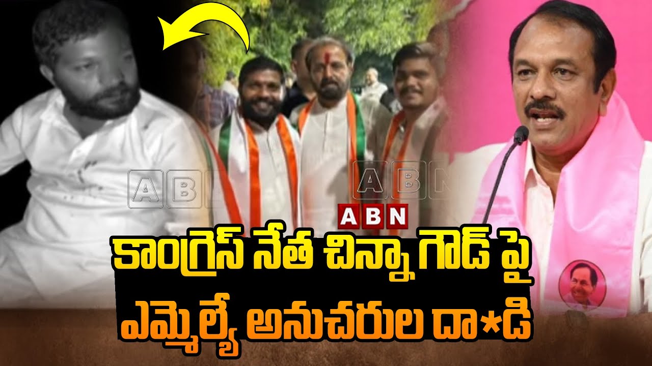 కాంగ్రెస్ నేత చిన్నా గౌడ్ పై ఎమ్మెల్యే అనుచరుల దా*డి | Congress Leader Chinna Goud | ABN Telugu