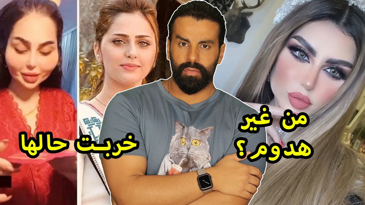 حليمة بولند تستعرض مفاتنها بلا ولا شي؟ بنت دنيا بطمة شو عملوا فيها؟ ملكة جمال العراق بعد التجميل ولو