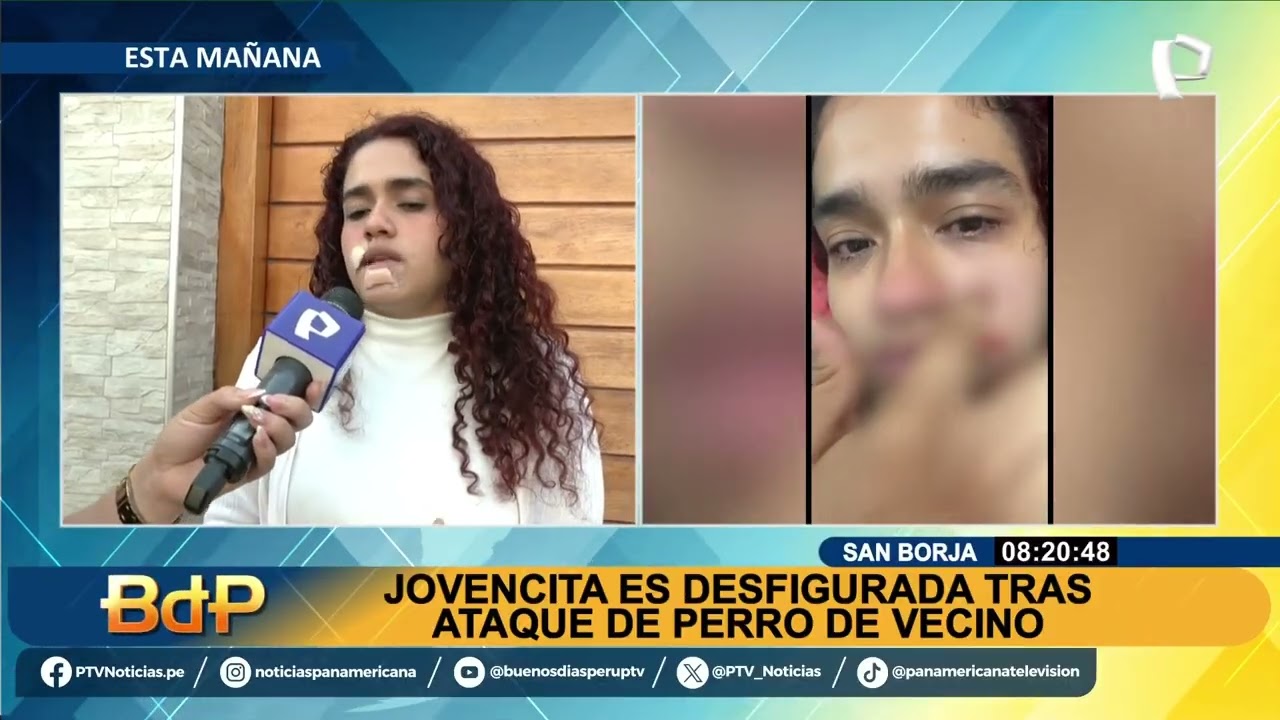 Joven pierde pedazo de oreja por ataque de pitbull en La Molina, Lima (Per&uacute;) (04-04-25)