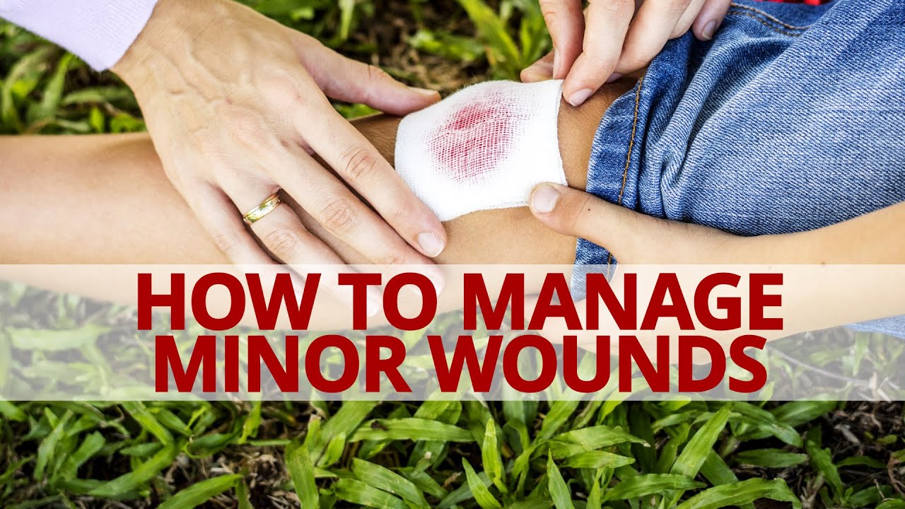 How to Manage and Give First Aid to Minor Wounds