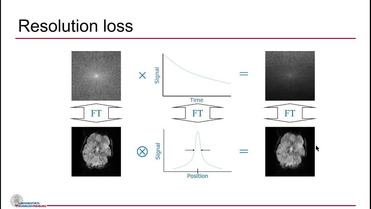 Maxim Zaitsev: EPI Artifacts