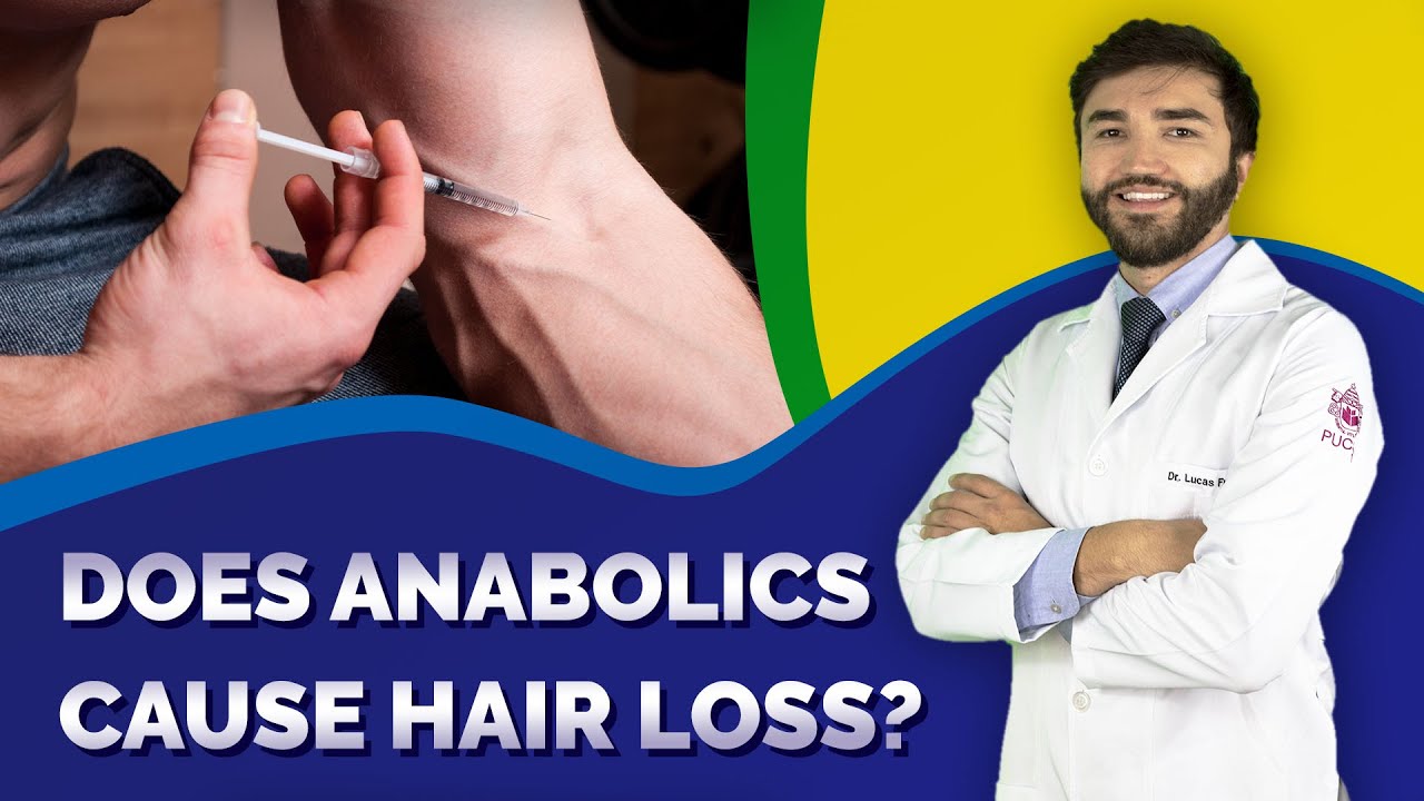 Does Anabolics cause hair loss?