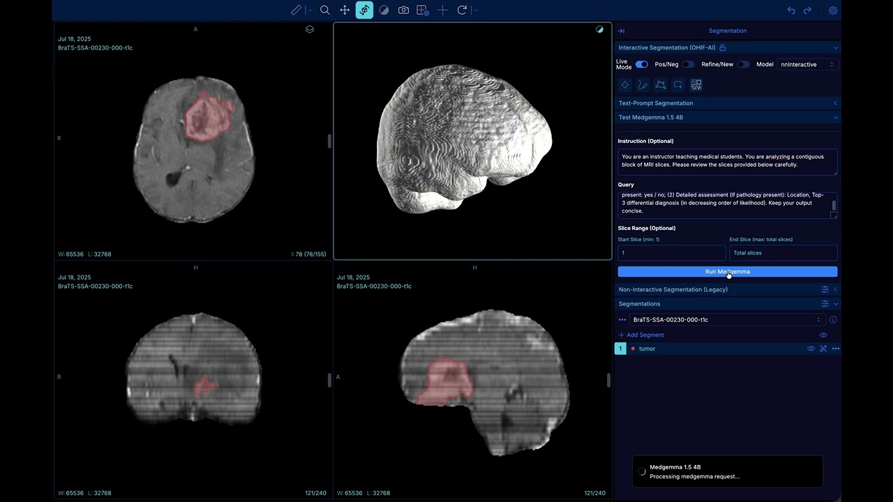 VoxTell Medgemma demo at OHIF