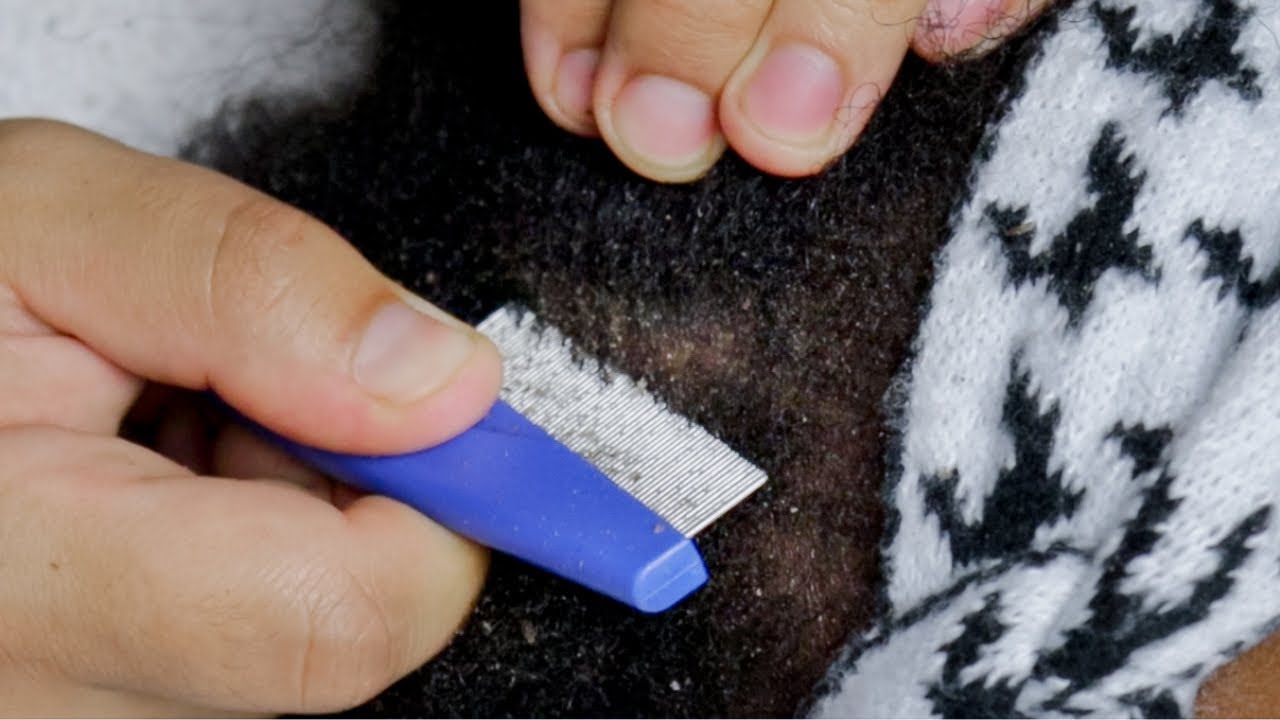 The DEEPEST SLEEP | Attentive Scratching A lot of Dandruff