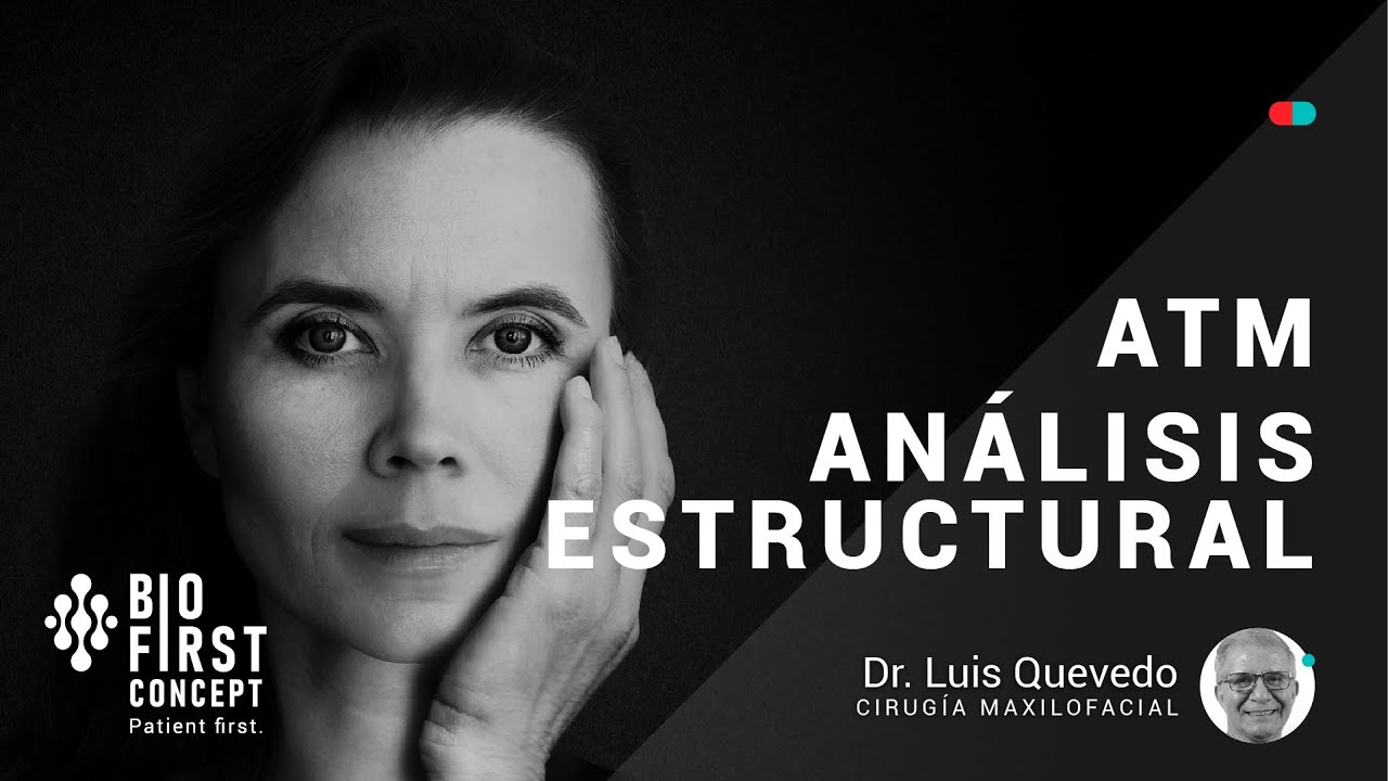 Análisis estructural de la ATM [ATM Series 10]