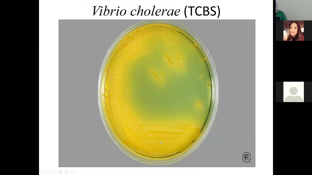 Microbiology | Vibrio | Aeromonas | Campylobacter Review