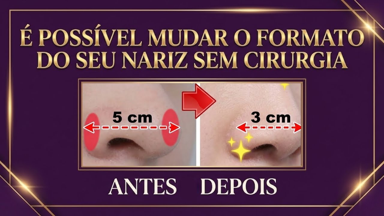 É POSSÍVEL MUDAR O FORMATO DO SEU NARIZ SEM CIRURGIA