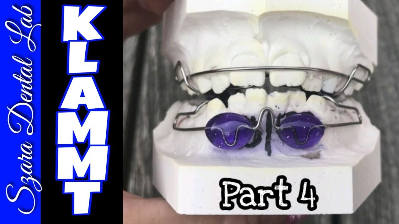 Klammt Acrylic and Finishing Part 4 of 4