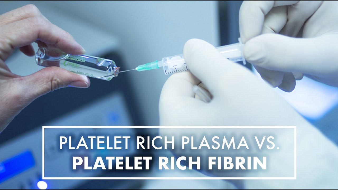 PRP Vs. Platelet Rich Fibrins | Dr Joseph Cleaver | Top10MD