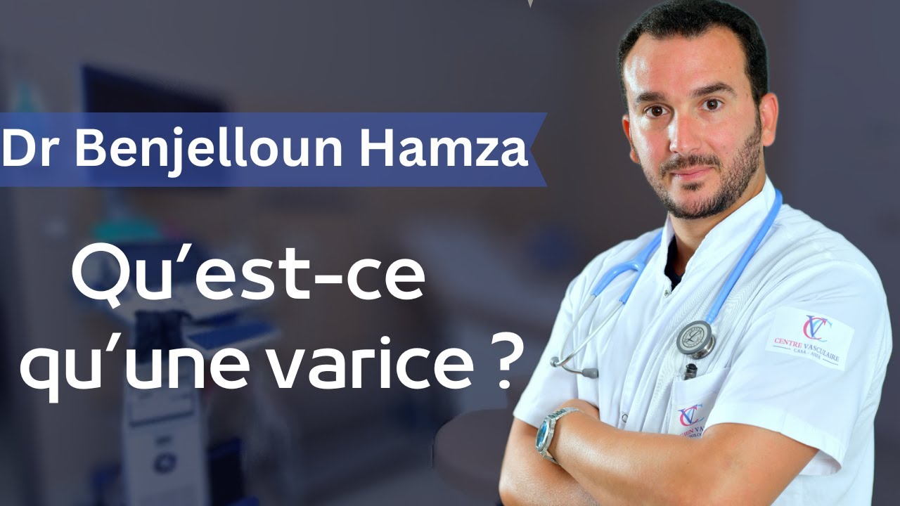 Qu&rsquo;est-ce qu&rsquo;une varice ?