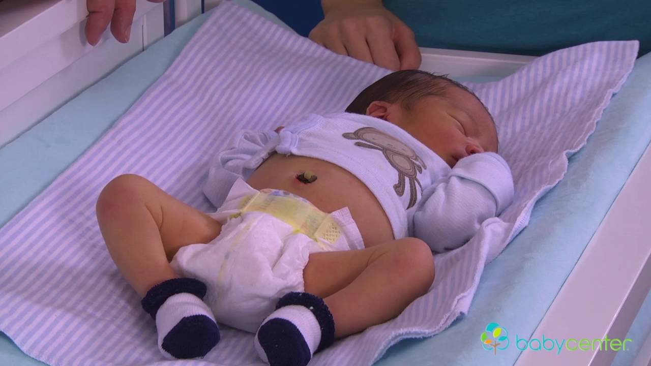 Cómo cuidar el cordón umbilical del recién nacido