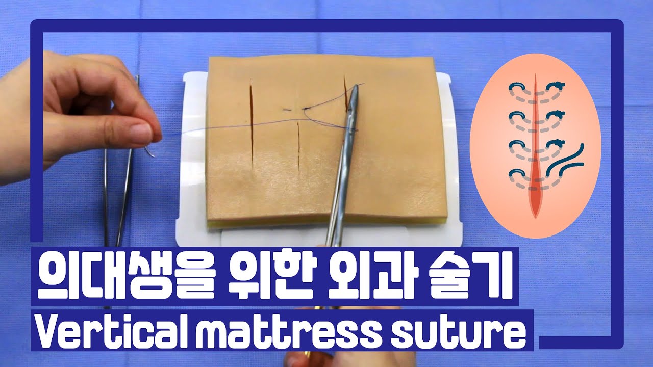 [서울성모병원] 외과 술기 2. Vertical Mattress Suture