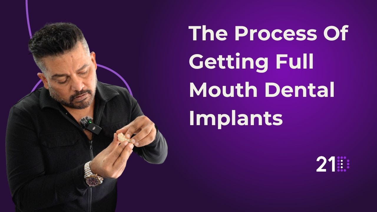 The Process Of Getting Full Mouth Dental Implants