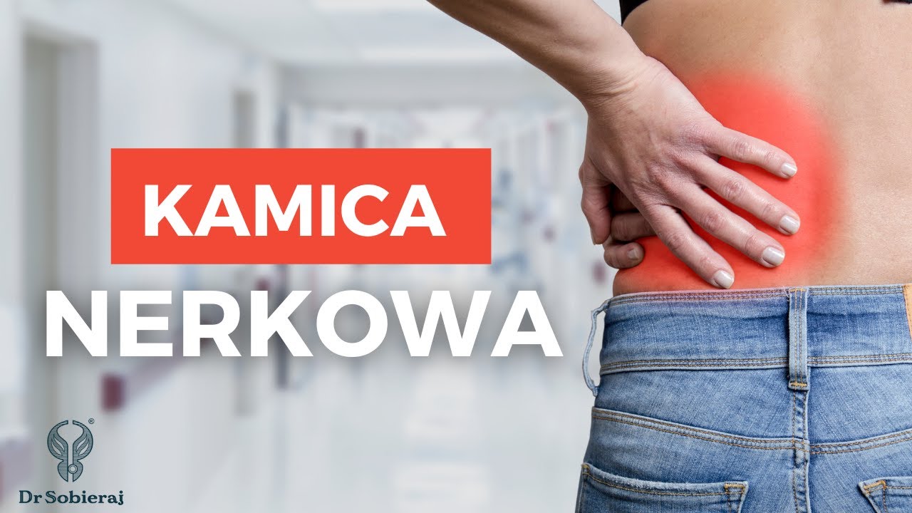 Kamica nerkowa - objawy i przyczyny