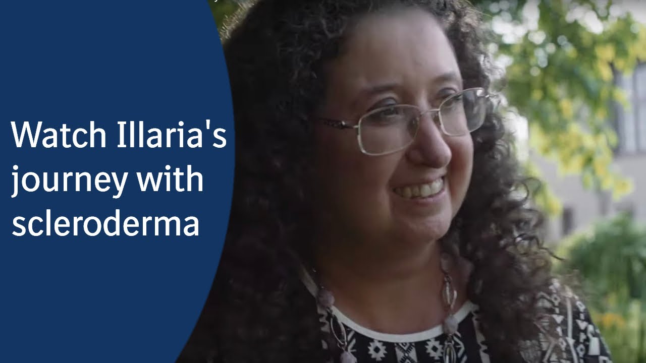 What happens when you have systemic sclerosis?