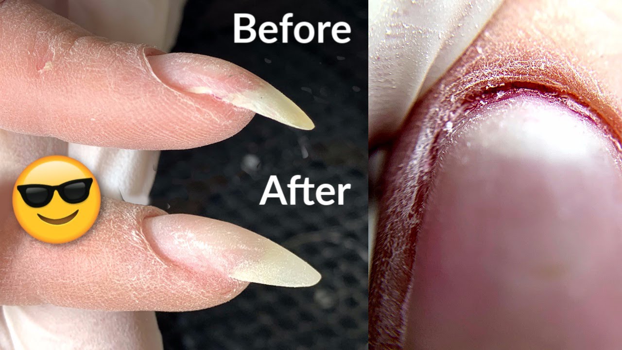 How to fix a Curved Nail | Manicure Transformation