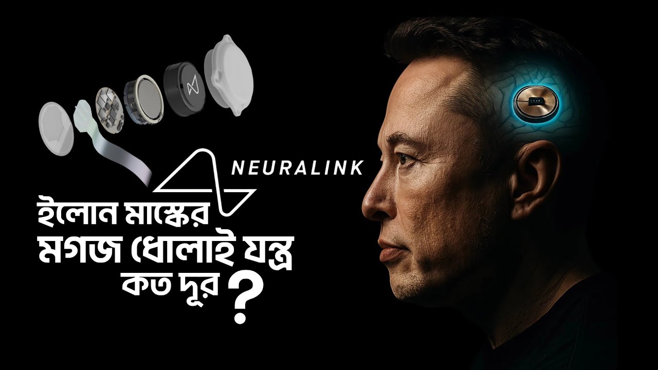 ইলন মাস্কের মগজ ধোলাই যন্ত্র কত দূর ?