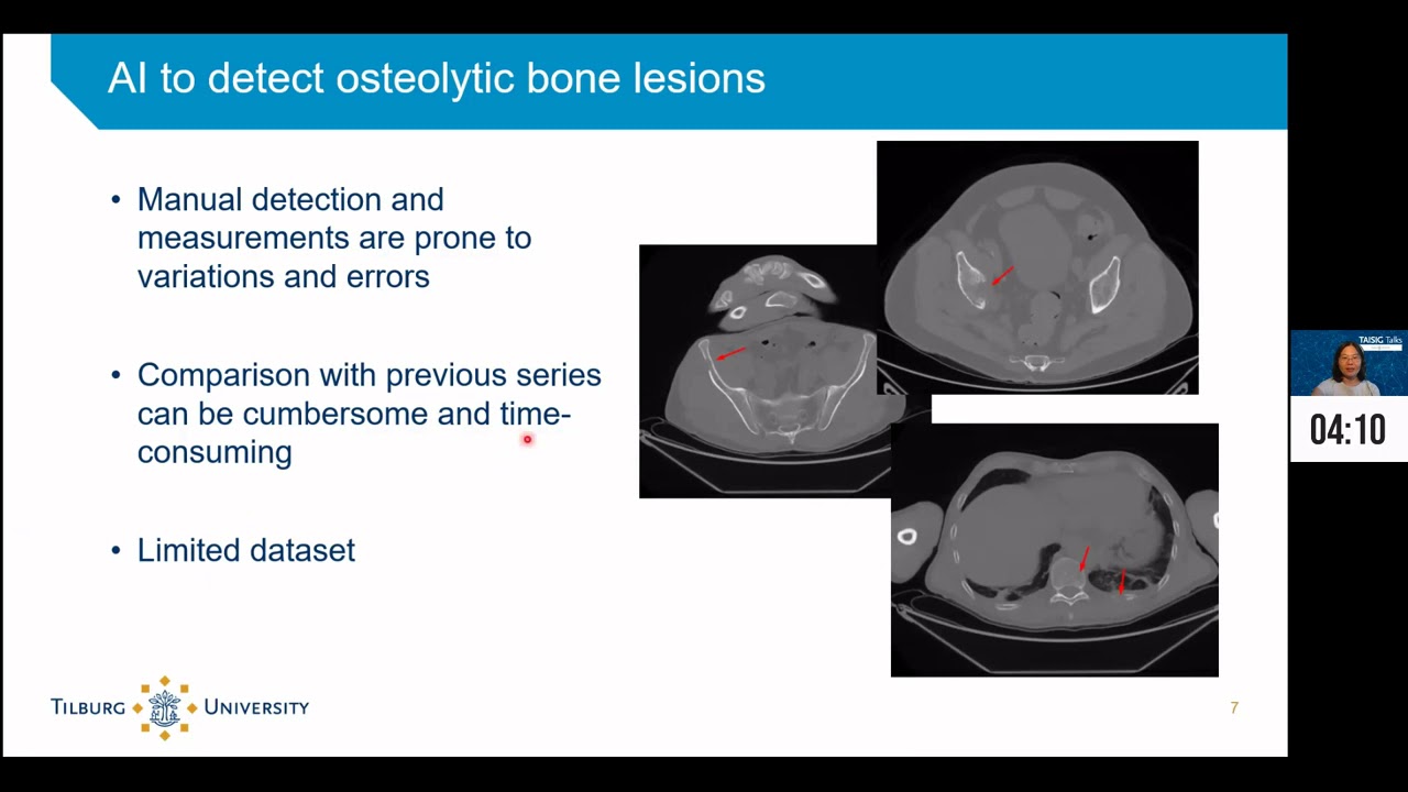 TAISIG Talks: Sharon Ong on AI for diagnostic imaging
