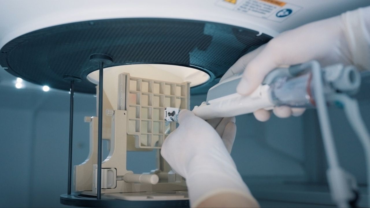 New: Image-Guided Vacuum-Assisted Biopsy