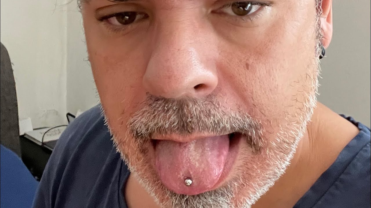 Ich habe mir ein Zungenpiercing machen lassen 14 Tage Erfahrung #zungenpiercen