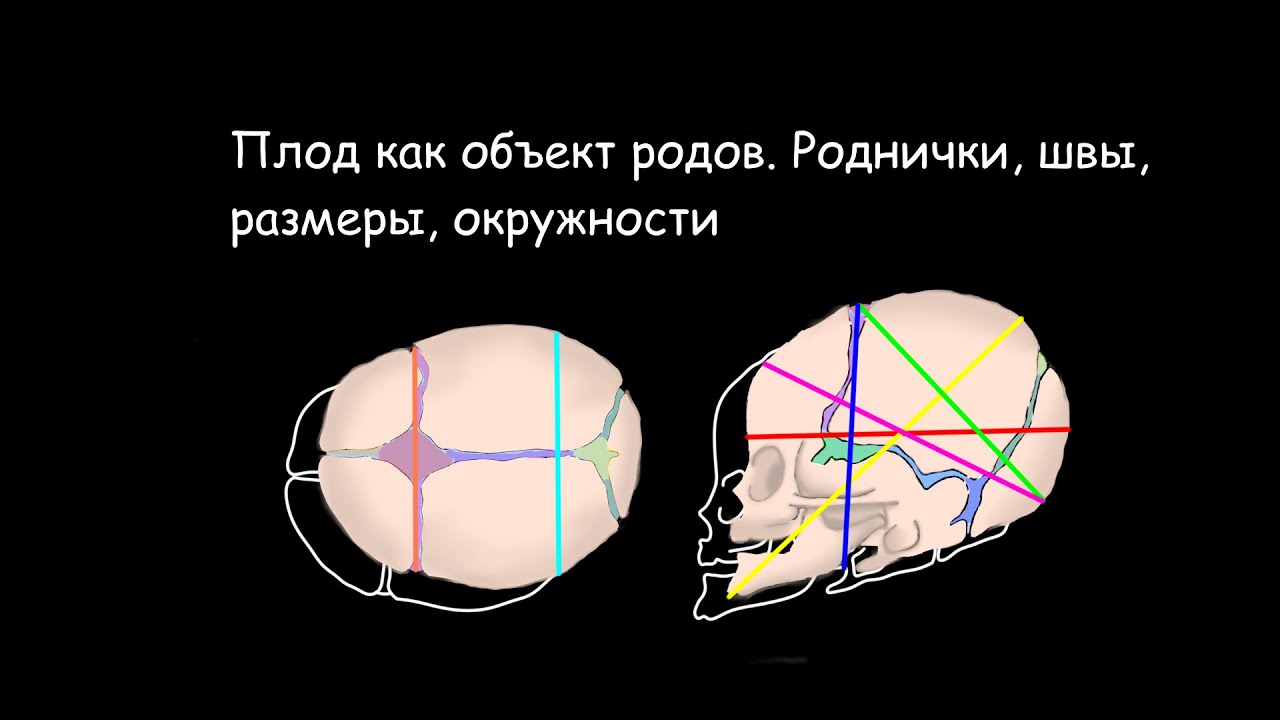 Плод как объект родов. Роднички, швы, размеры, окружности головки плода