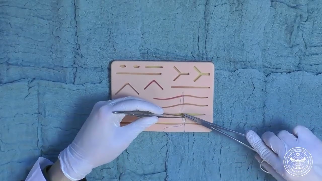 Sutura „U Orizontal”