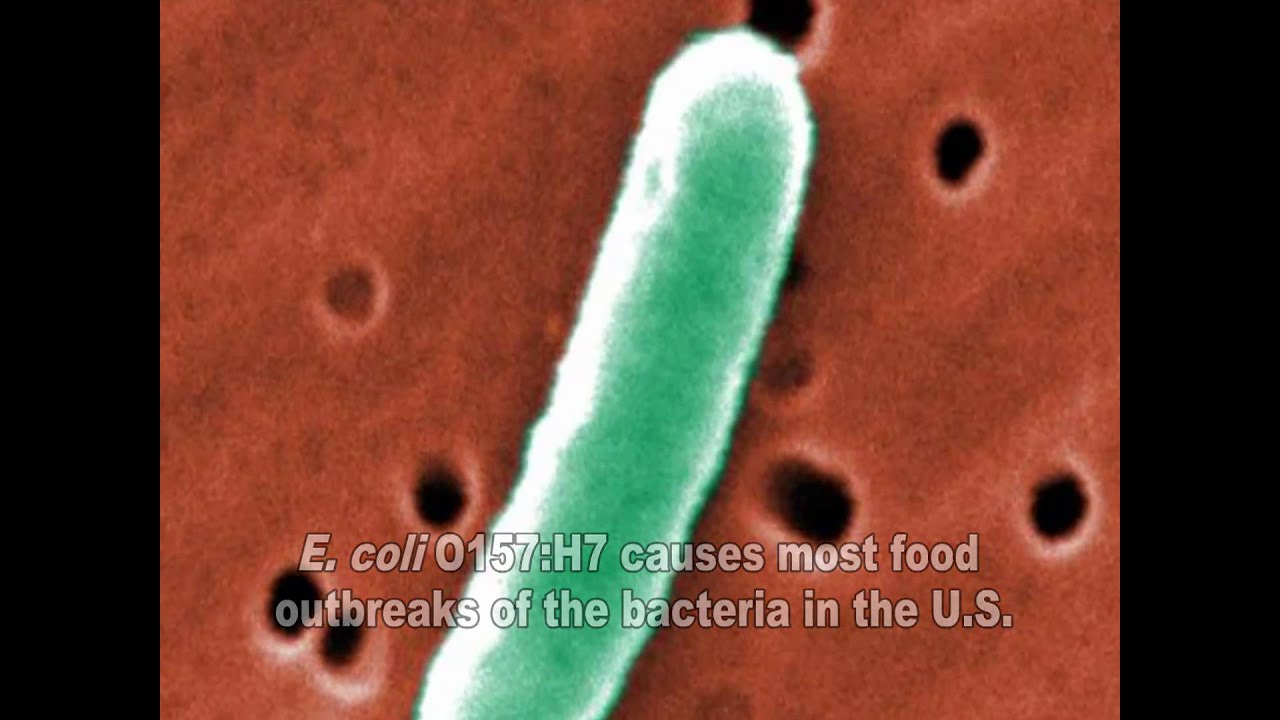 E.  coli  Video