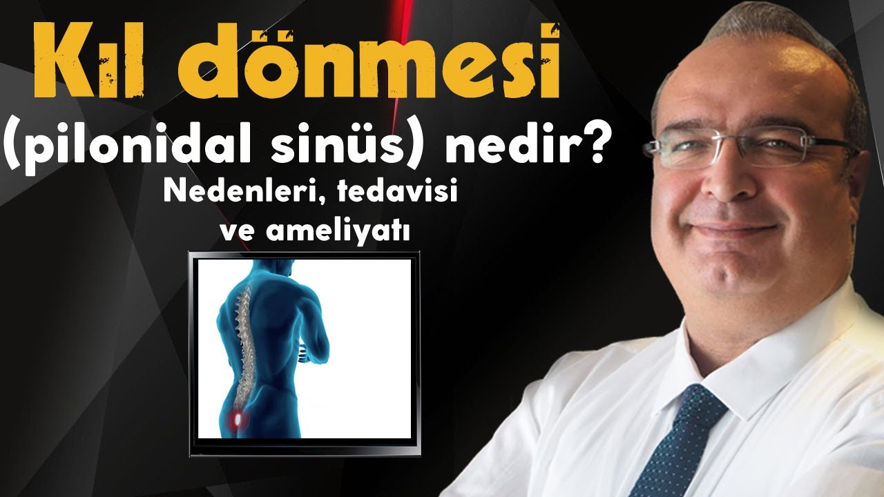 Kıl dönmesi (pilonidal sinüs) nedir? Nedenleri, tedavisi ve ameliyatı