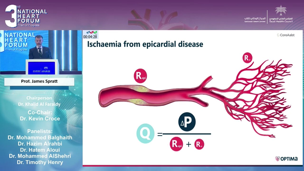 29  Prof  James Spratt   The Pathophysiology of Angina &ndash;More Than Meets The eye