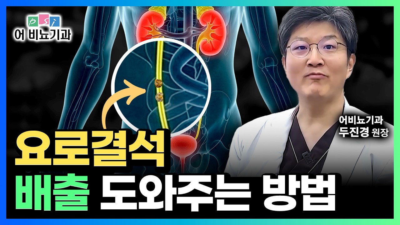 요로결석 빨리 나오게 하려면? 당장 이 동작 해보세요 (비뇨의학과 전문의)