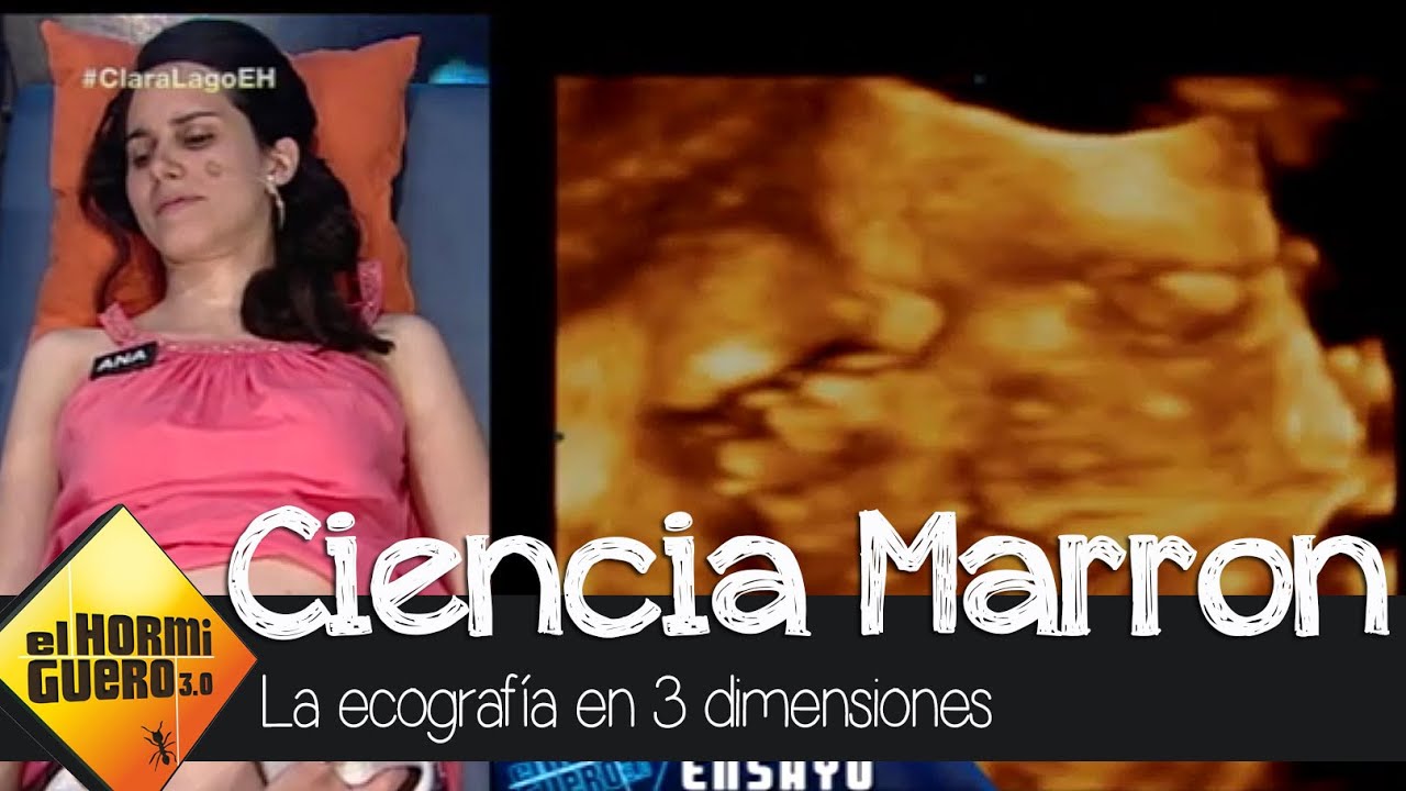 Ciencia de Marron: La ecografía en 3 dimensiones - El Hormiguero 3.0