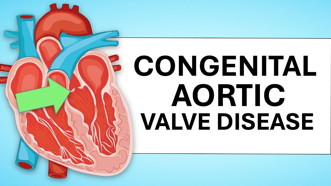 Patient Webinar: Advances in Congenital Aortic Valve Disease Therapy