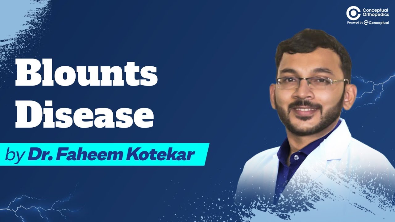 Understanding Blounts Disease - A Comprehensive Discussion by Dr. Faheem Kotekar