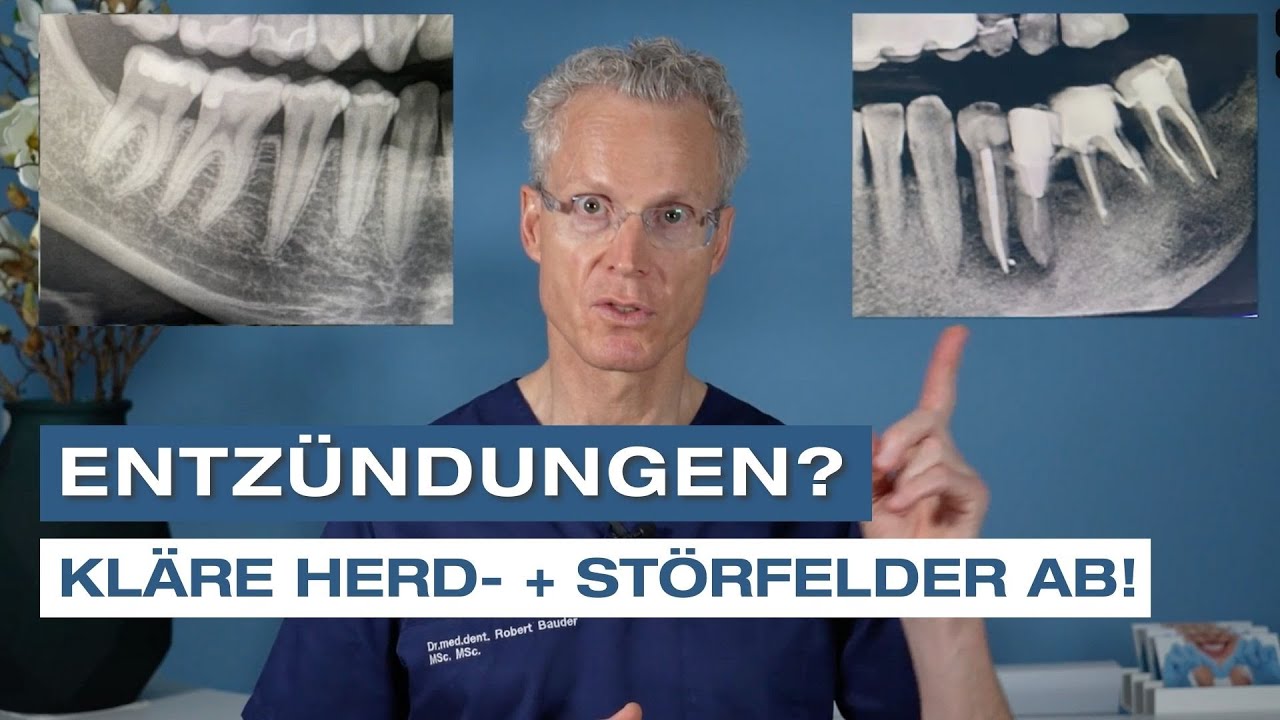 Wieso es wichtig ist Herd- und St&ouml;rfelder rund um Deine Z&auml;hne und Stille Entz&uuml;ndungen abzukl&auml;ren.