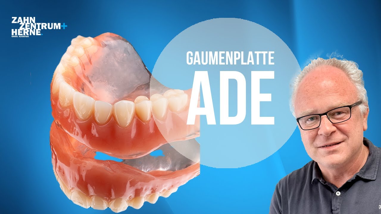 Von der Gaumenplatte zum sicheren Halt – Teleskop einfach erklärt