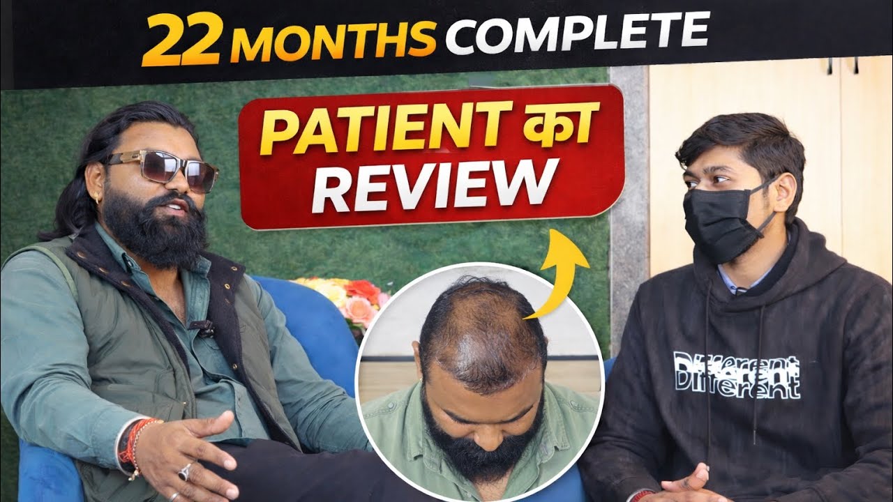 Hair transplant ने पूरी life बदल दी 😊 || 22 months hair transplant result