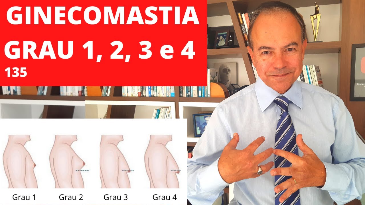 GINECOMASTIA - Explicando os 4 graus da MAMA MASCULINA [Cirurgia Plástica]